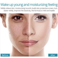 Oil Control Pore Shrink Face Cream Moisturizing Remove Dark Spots Improve Acne Blackheads Dry Whiten Skin Care เครื่องสำอางเกาหลี