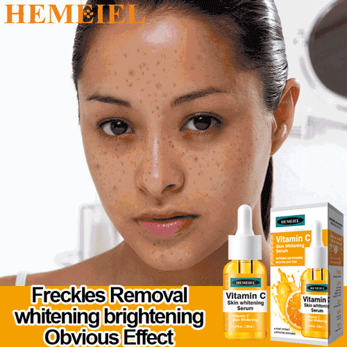 HEMEIEL Melasma Removal Cream Original Set/Serum Vitamin C & Collagen