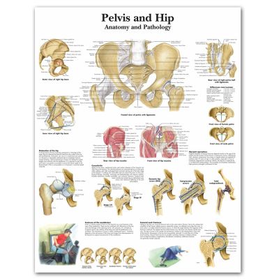 Wang กระดูกเชิงกรานและสะโพกแผนภูมิกายวิภาคศาสตร์และพยาธิวิทยาโปสเตอร์ผ้าใบพิมพ์ลายรูปภาพติดผนังสำหรับการศึกษาทางการแพทย์ตกแต่งบ้านสำนักงาน