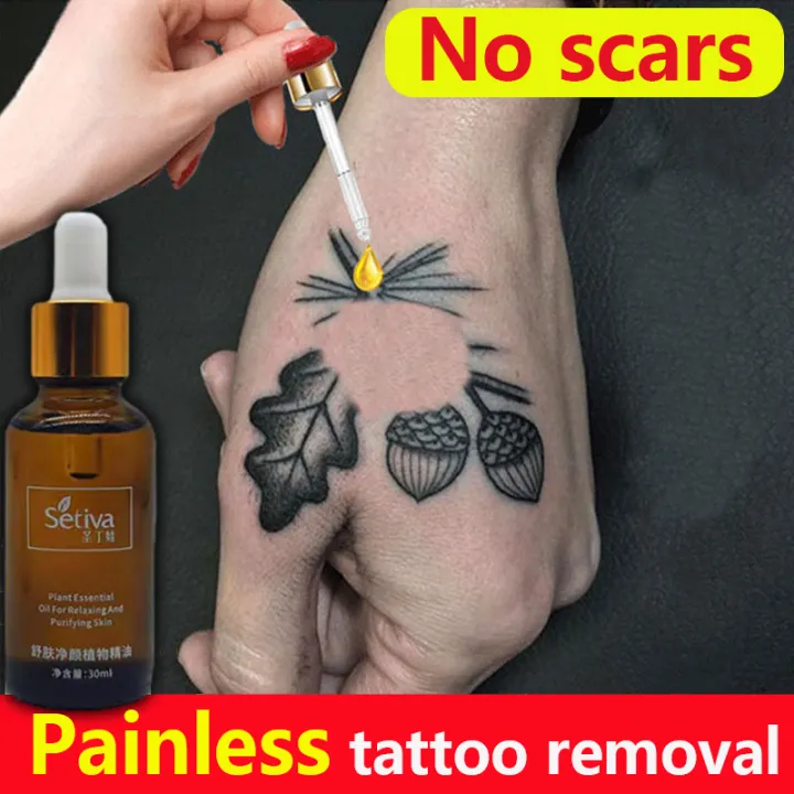 Techniques for Painless Tattoo Removal  OpenGrowth