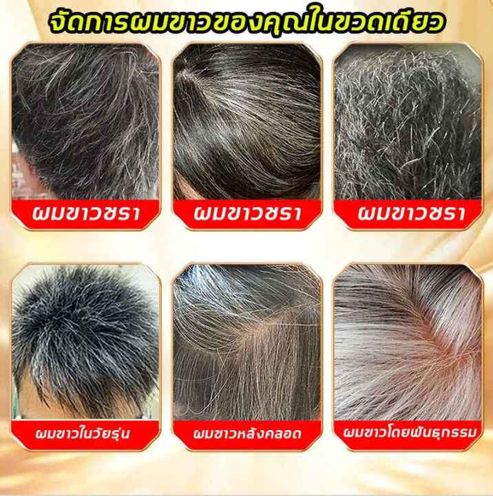 พร้อมส่ง-ผมดำจากรากอย่างเป็นธรรมชาติ-tk-แชมพูแก้ผมหงอก-300ml-สูตรพืช-ไม่ต้องย้อมผม-ใช้งานสะดวก-เหมาะกับผู้มีปัญหาผมขาว-แก้ผมหงอกถาวร-แชมพูปิดหงอ-แชมพูปิดผมหงอก-ติดทนนาน-ยาสระผมปิดหงอก