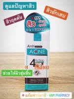 VITARA ANTI ACNE GEL 4 ACTIVE ไวทาร่า แอนตี้ แอคเน่ เจล เจลแต้มสิวสูตรใหม่ ไม่มีส่วนผสมของแอลกอฮอล์