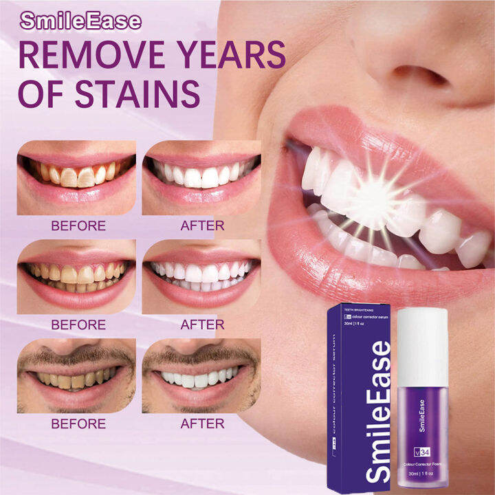 smile-ease-toothpaste-v34-teeth-whitening-color-corrector-teeth-colour