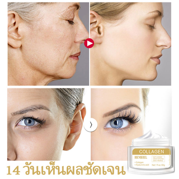 hemeiel-เจลใบบัวบก-ครีมขมิ้น-retinol-หน้าเรียบเนียน-ผิวอ่อนเยาว์-ทีลดเลือนริ้วรอย