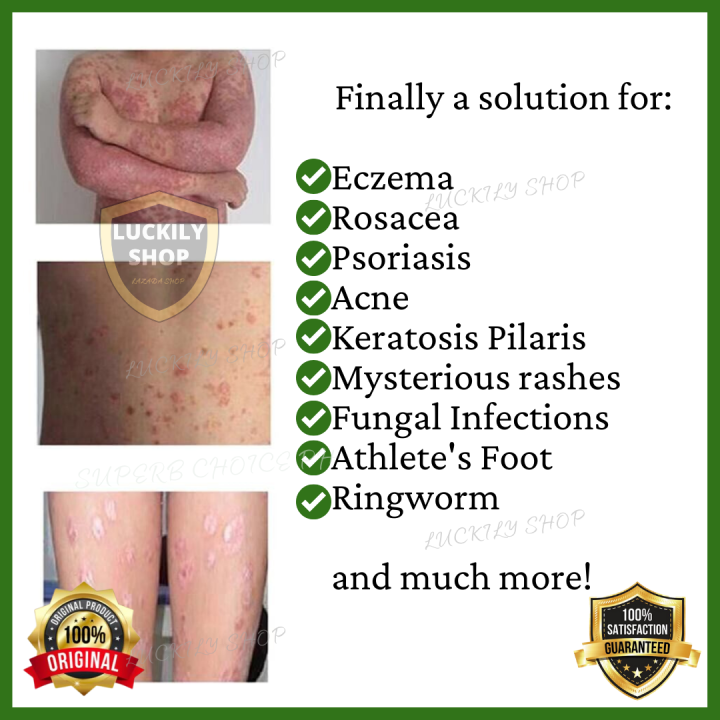 100 ORIGNAL Proven & Tested MIRACLE HERBAL MlLLENNlUM GRASS Solution