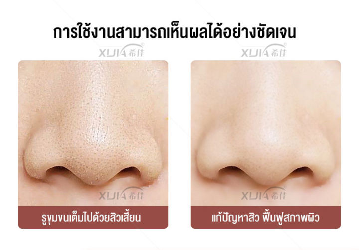 เครื่องดูดสิวเสี้ยน-เครื่องกำจัดสิวหัวดำ-ทำความสะอาดสิ่งสกปรกที่อุดตันรูขุมขนบริเวรจมูก-เครื่องดูแลผิวหน้า-ปรับได้-3-ระดับ