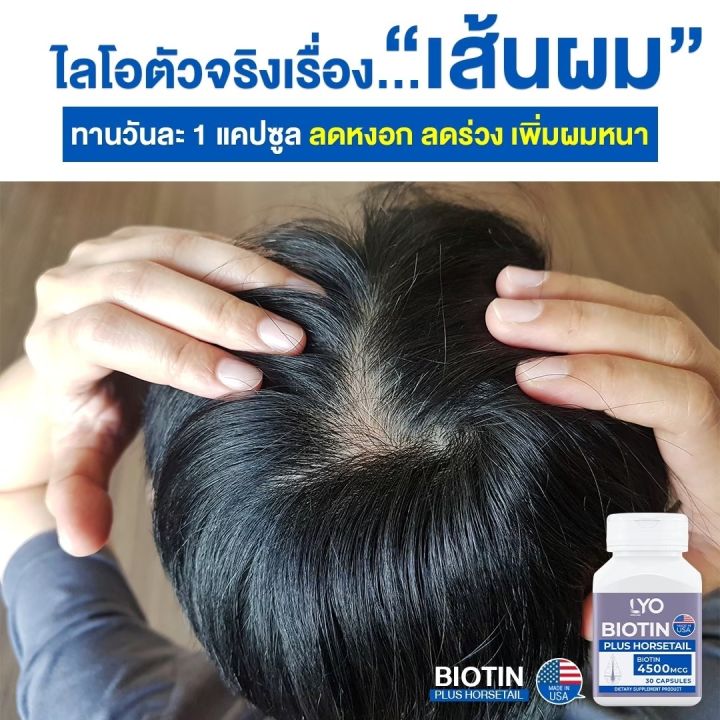 lyo-biotin-ไลโอ-ไบโอติน-วิตามินบำรุงเส้นผมชนิดรับประทาน-ลดผมร่วง-ชลอผมหงอก-เพิ่มผมใหม่-โดยหนุ่ม-กรรชัย-ส่งฟรี