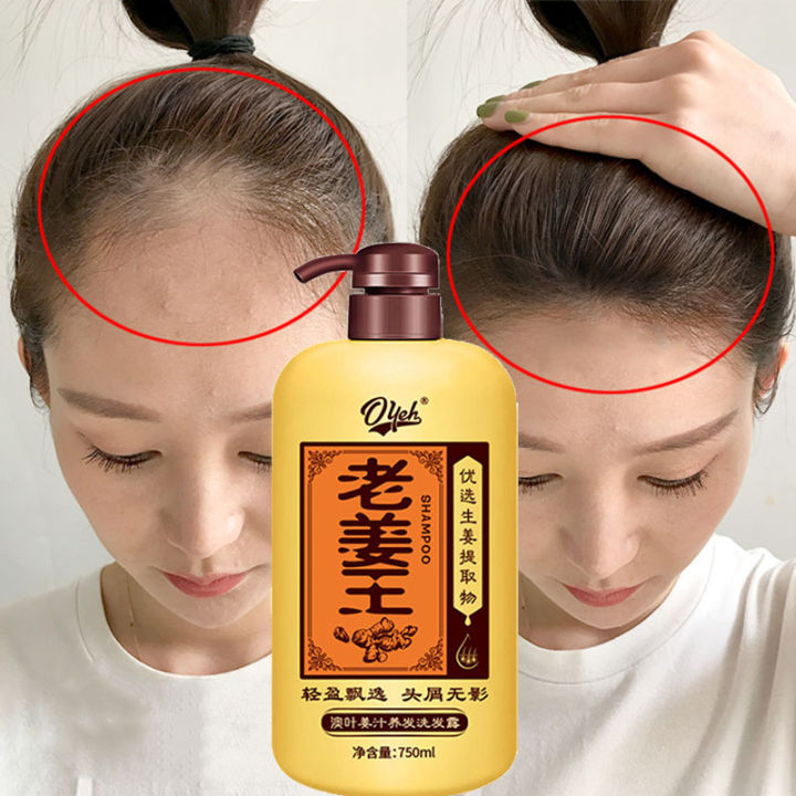 Natural Ginger Shampoo For Hair Loss Herbal Ginger Extract Hair Grower Effective Anti Hair Fall 2791