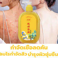 ครีมอาบน้ำหอมๆ tanya408ml กำจัดไร อุดมไปด้วยกำมะถันกำจัดไรสิ่งสกปรกยับยั้งไร ล้างให้มีผิวสวยใสไร้สิวออกมา บอกลาผิวหยาบกร้าน อ่อนโยนไม่ระคายเคือง กำจัดไร ของเหลวอาบน้ำ สบู่อาบน้ำหอมๆ ครีมอาบน้ำกำจัดไร เจลอาบน้ำ ครีมอาบน้ำเด็ก เจลอาบน้ำกำจัดไร