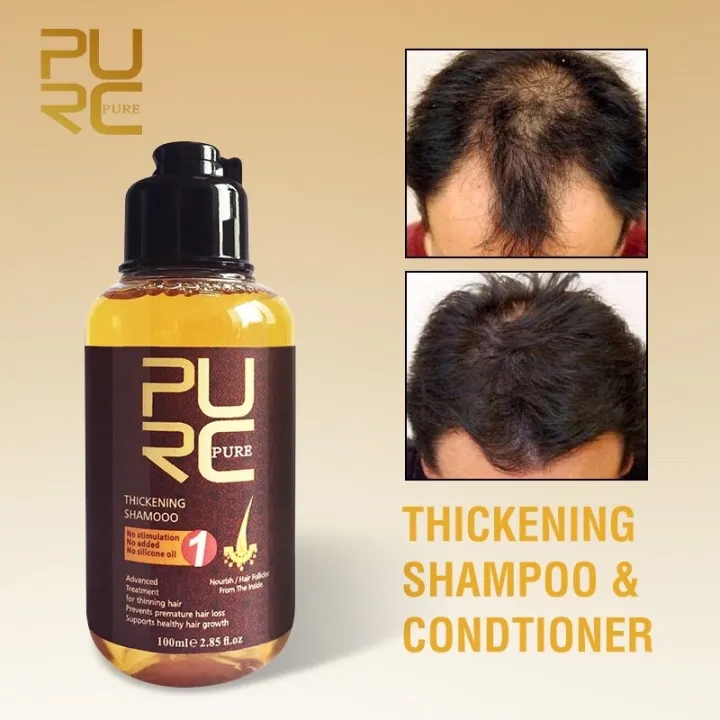 Purc Hair Growth Shampoo Ginger Growing Hair Prevent Hair Loss Hair Purc Hair Growth Shampoo Ginger Growing Hair Prevent Hair Loss Hair
