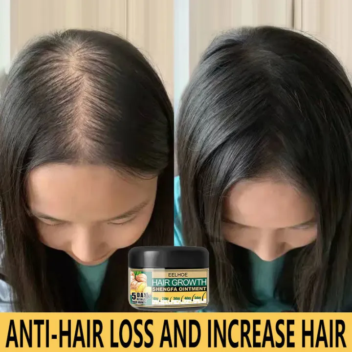 Hair Grower For Men Original Hair Grower Fast Long Hair Hair Growth Hair Growth For Men Hair Grower For Men Original Hair Grower Fast Long Hair Hair Growth Hair Growth For Men