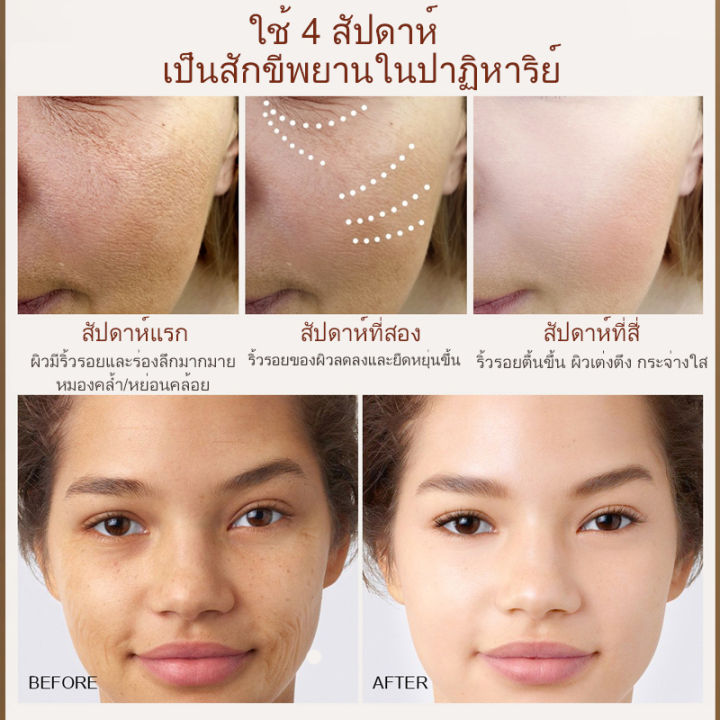 นำเข้าจากญี่ปุ่น-เกาหลี-ครีมลดริ้วรอย-ลดริ้วรอย-ปรับผิวหมองคล้ำ-ลดเลือนริ้วรอย-ครีมต่อต้านริ้วรอย-ไวท์เทนนิ่งครีม-ผิวขาวใส