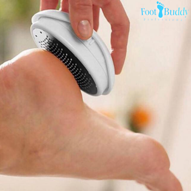 ที่ขัดส้นเท้า-ช่วยขจัดส้นเท้าที่แตกแห้งและเซลล์ผิวที่ตายแล้วให้หมดขนาดกระทัดจับถนัดมือใช้งานสะดวก