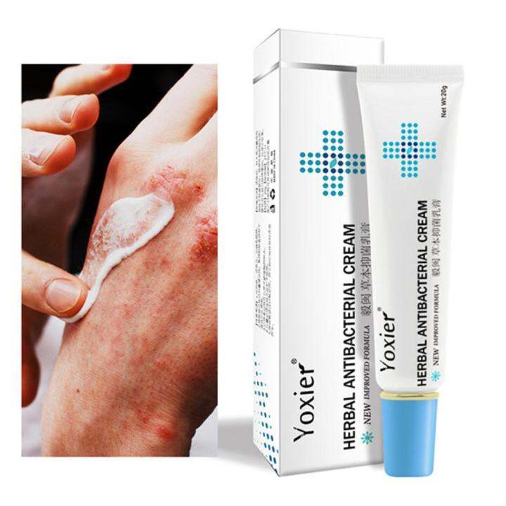 Hold Live Yoxier 20g Skin Rash Cream Eczema Ointment Anti Fungal Cream Psoriasis Treatment Cream 8185