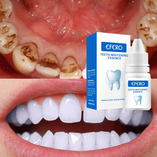 Efero gel serum làm trắng răng loại bỏ vết ố răng và mảng bám làm sạch - ảnh sản phẩm 1