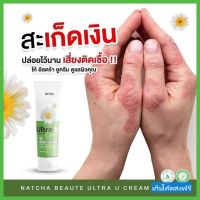 ของแท้ 100% Natcha Ultra U นัชชา อัลตร้ายู ครีม ลดปัญหาผิว (30 g) เก็บโค๊ดส่งฟรี