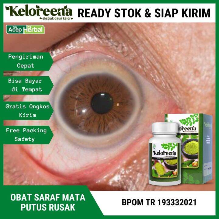 Obat Herbal Saraf Mata Putus Rusak Mata Ptosis Mata Buram Dan