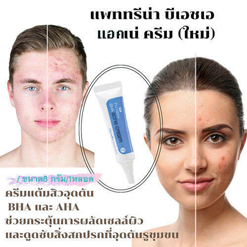 hot-sale-แก้สิวอักเสบด้วยกิฟฟารืนครีมแต้มสิวแพททรีน่าช่วยยับยั้งแบคทีเรีย-8กรัม-1หลอด-รหัส22106-lung-d-ของแท้100