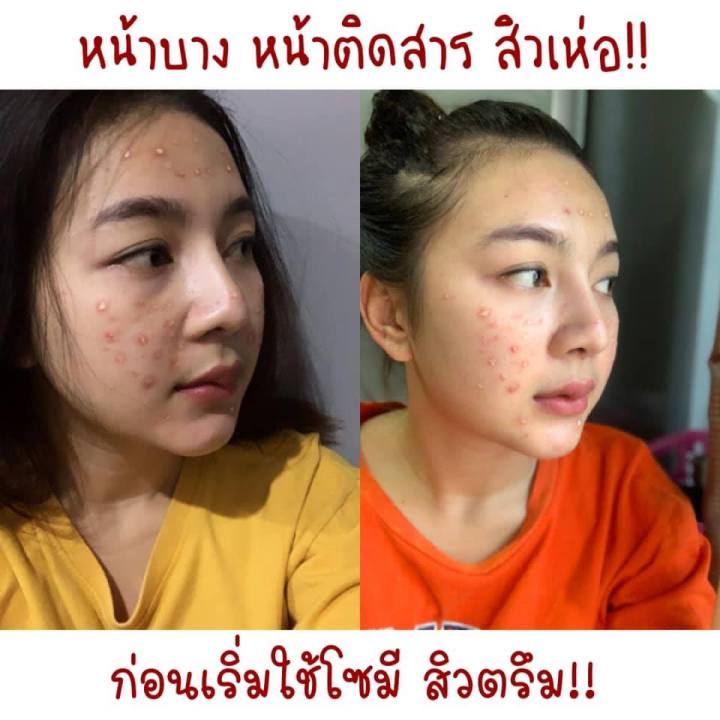 ครีมโซมี-ครีมโสม-หน้าใส-จินเส็ง-so-me-jinseng-brightening-cream