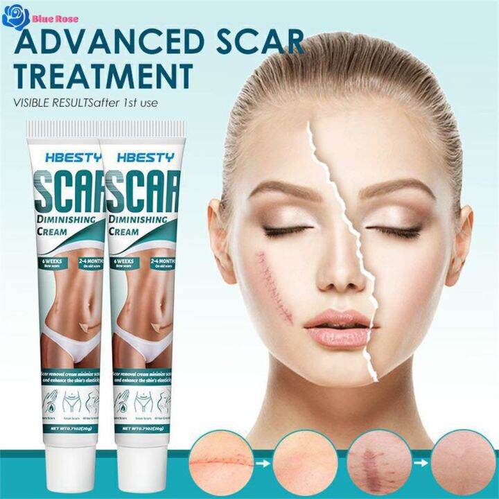 Blue Rose HBESTY Light Scar Gel Acne Print Burn Surgery Scar Cesarean Section Scar Stretch Mark