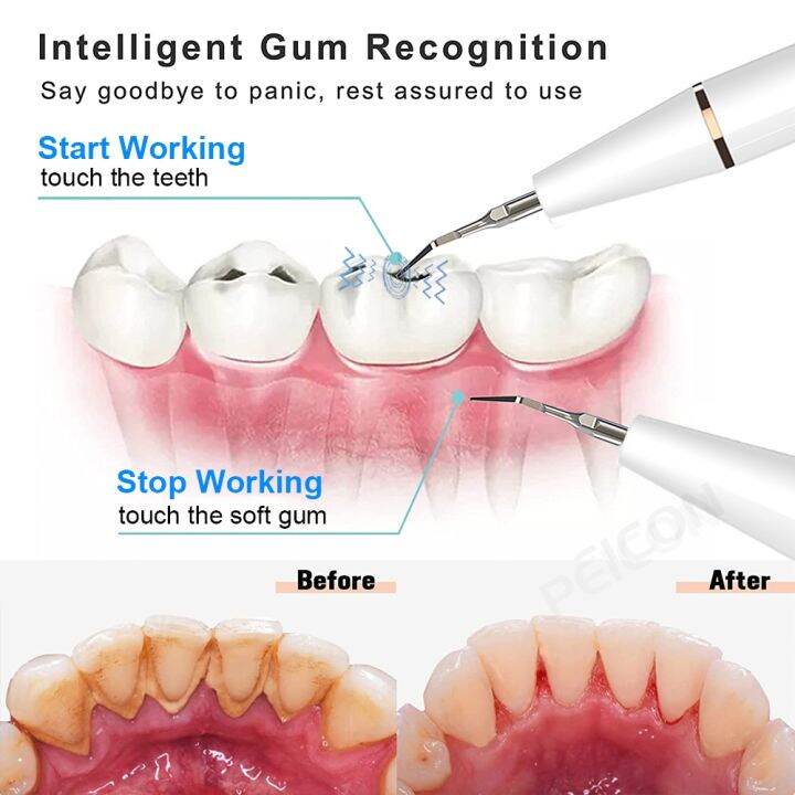 cw-ultrasonic-scaler-teeth-tartar-stain-calculus-remover-electric-plaque-cleaner-stone-removal