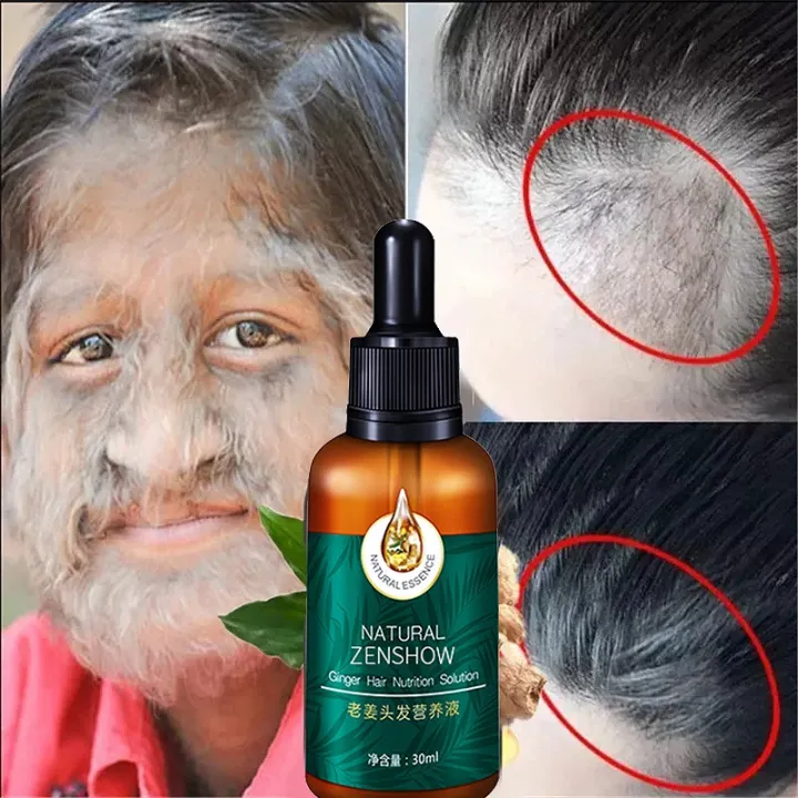 【COD】Herbal Essence Ginger Hair Nutrition Liquid 30ml Fast Promotes