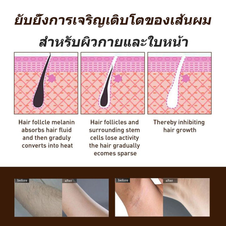 disaar-กำจัดขนสเปรย์-30ml-กำจัดขนถาวรมูสกำจัดขนอ่อนมูสครีมกำจัดขนน้องสาวกำจัดขนถาวรมูสกำจัดขนสเปรย์สามารถใช้ทั้งร่างกายและไม่เป็นอันตรายต่อผิว