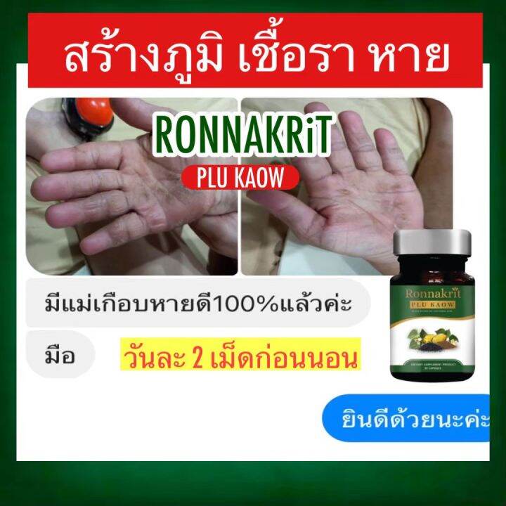 ส่งฟรี-พร้อมส่ง-สะเก็ดเงิน-กลากเกลื้อน-เชื้อรา-สมุนไพรพลูคาว-รณกฤต-อาหารเสริมสมนไพร-พลูคาวสกัด-ภูมิคุ้มกัน-ร่างกายสมดุล