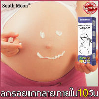 【ใช้ได้ทั้งรอยแตกลายใหม่และเก่า】ครีมทาท้องลาย สำหรับกาซ่อมแซมผิวหลังคลอด ทำให้ผิวชุ่มชื้น ซ่อมแซมรอยแตกลาย ลบรอยแตกลายได้อย่างมีประสิทธิภาพ（ครีมทาแตกลาย,ครีมทารอยแตกขา,ครีมกันแตกลาย,ครีมทารอยแตก,ครีมรอยเเตกลาย,ครีมทาหลังคลอด,ครีมแก้แตกลาย,ครีมแก้ท้องลาย）