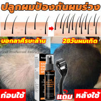 West&amp;Month สเปรย์ปลูกผม30ml น้ำยาปลูกผม ป้องกันหัวล้าน ป้องกันผมร่วง รักษาผมร่วง เร่งผมงอกใหม่บำรุงผมฟื้นฟูผมแห้งเสีย แก้ปัญหาผมร่วง ผมสวย เงางาม เซรั่มปลูกผม น้ำมันปลูกผม ปลูกผม ยาปลูกผม เซรั่มบำรุงผม เชรั่มปลูกผม ยาปลูกผมผู้ชาย น้ำยาเร่งผมยาวHair Growth