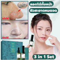 AOPY สูตรอ่อนโยน กำจัดสิวหัวดำ 3 in 1 Set ลบสิวหัวดำและสิว บำรุงกระชับรูขุมขน ขจัดผิวที่ตายแล้ว ผิวกระจ่างใส ครีมลอกสิวเสี้ยน ลอกสิวหัวดำ สิวอุดตัน ลอกได้ทั้งหน้า สูตรใหม่ สำหรับคนเป็นสิว และผิวแพ้ง่าย ( ที่ลอกสิวเสี้ยน ลอกสิวเสี้ยน มาร์คหน้าสิวเสี้ยน)