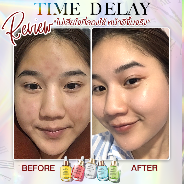 สูตรใหม่-พร้อมส่ง-เพิ่มโสม-คอลลาเจน-ทองคำ-สูตรสลายฝ้าหนัก-time-delay-serum-ไทม์ดีเลย์-เซรั่มย้อนวัย-เซรั่มเมย์-พิชญ์นาฏ-เซรั่มสูตรแพทย์