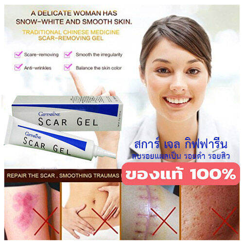 hot-sale-กิฟารีนสการ์-เจลลบรอยแผลเป็นรอยดำรอยสิว-ปริมาณ15กรัม-1หลอด-รหัส14005-lung-d-ของแท้100