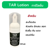 Tar lotion โลชั่นน้ำมันดิน ทาร์โลชั่น มอยเจอร์ไรเซอร์ ครีทาผิว ครีมโลชั่นบำรุงผิว ผิวแห้ง ผื่น คัน ขนาด 120 ml.