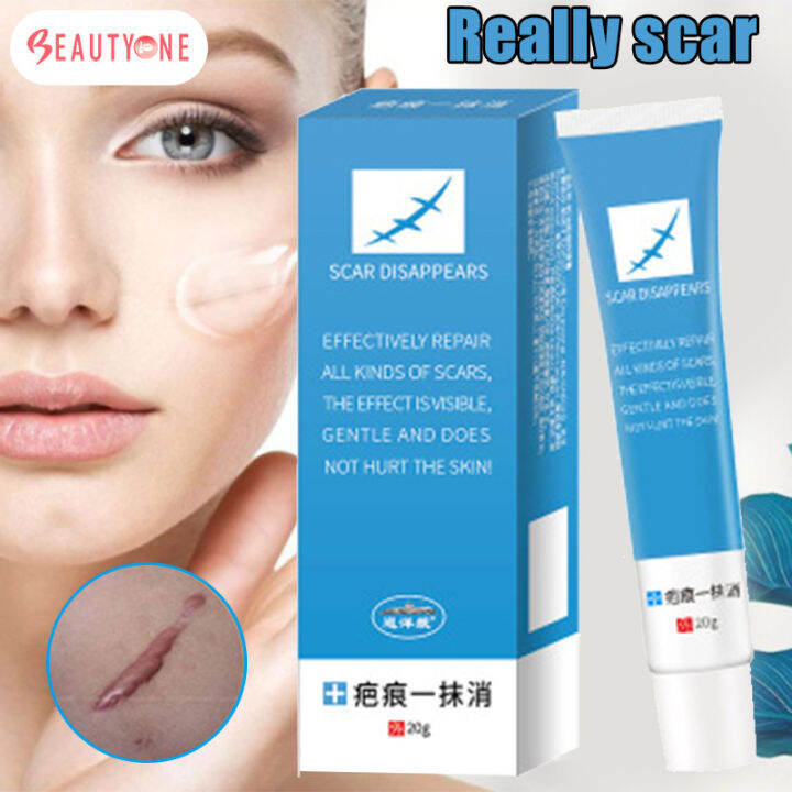 TCM SCAR & ACNE MARK REMOVAL GEL CREAM (20G) THIS OINTMENT HEALS CUT ...