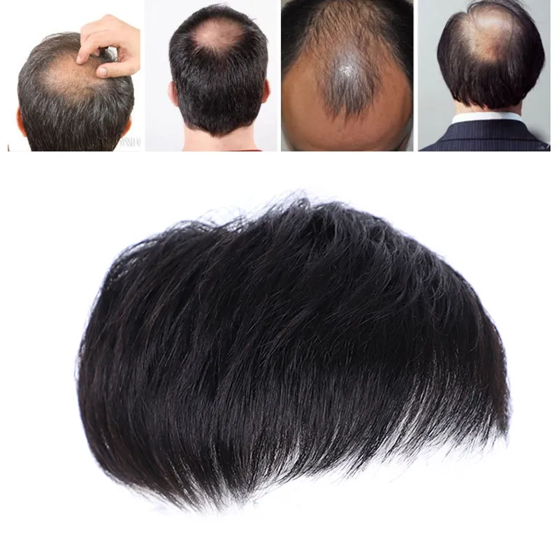 Tóc Giả Mái Hói Nam Giá Tốt T10/2023 | Mua tại Lazada.vn