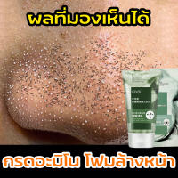 ?ซื้อ 3 แถม 2?โฟมล้างหน้า โฟมเข้มข้น ทำความสะอาดผิวอย่างล้ำลึก ซ่อมแซมรูขุมขน ลดความมัน เลือนสิว บำรุงผิว อ่อนโยน（สบู่ล้างหน้า โฟม ล้างหน้า เจลล้างหน้า โฟมล้างหน้าผญ ครีมล้างหน้าไวท์เทนนิ่ง โฟมล้างหน้าชาย โฟมล้างหน้าสิว โพมล้างหน้า )