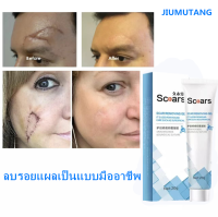 เหมาะสำหรับรอยแผลเป็นทุกชนิดปลอดภัยและมีประสิทธิภาพ ครีมทาแผลเป็น20g.ยาทาแผลเป็นนูน ยาลบลอยแผลเป็น ครีมลดแผลเป็น ยาลดรอยแผลเป็น ลบรอยแผลเป็นแบบมืออาชีพ ทำแค่ครั้งเดียว ครีมลบแผลเป็น เร่งการซ่อมแซมผิวที่ถูกทำลาย