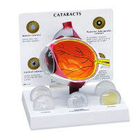 4X มนุษย์ Pvc Eye Cataract Anatomy Teaching Model