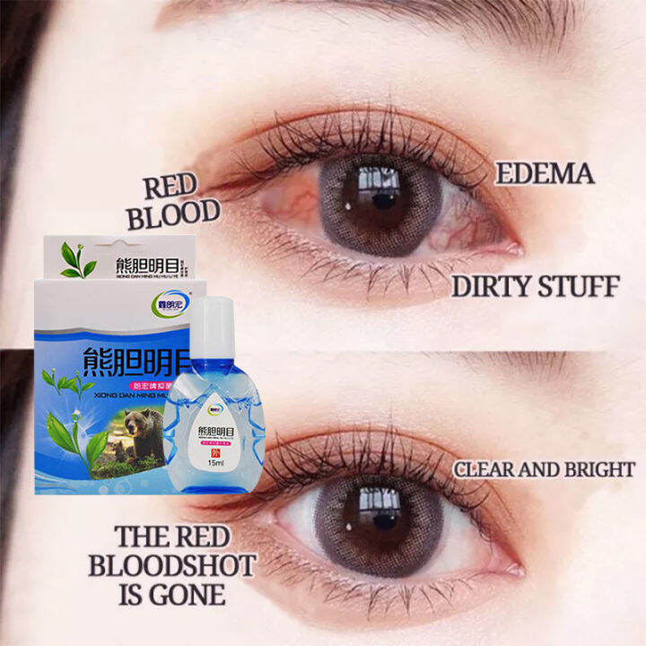 15ML crystalix for eyes drops blueberry eye drops from japan japanese eye drops for dry eyes