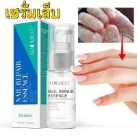 ของแท้ 100% AUQUEST เซรั่มบำรุงเล็บ น้ำยาบำรุงเล็บ 20ml บำรุงเล็บ ต่อต้านการติตเชื้อรา ซ่อมแซมเล็บแตก เล็บเปราะ เล็บหนา ซ่อมแซมเล็บที่เสียหาย การดูแลเล็บ ขจัดคราบเล็บ