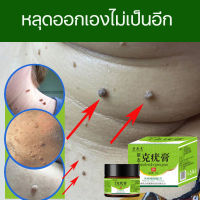 wart  remover cream ยาแต้มหูด 20g ลอกหูดตาปลา ปลอดภัยไม่เจ็บตัว ขจัดติ่งเนื้อ เอสเซ้นลอกหูด ไม่ทิ้งร่องรอยป ครีมกําจัดไฝหูดติ่งเ