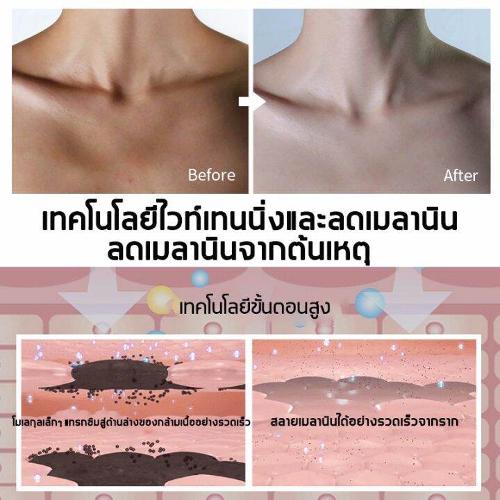 roushun-สบู่วิตามิน-ค-สูตรเพิ่มวิตามินซี-สบู่ขาวสีส้ม-ครีมขาวเร่งขาว-สบู่ไวท์เทนนิ่ง-ช่วยทำความสะอาดใบหน้าและร่างกาย-สบู่เร่งผิวขาว-ข