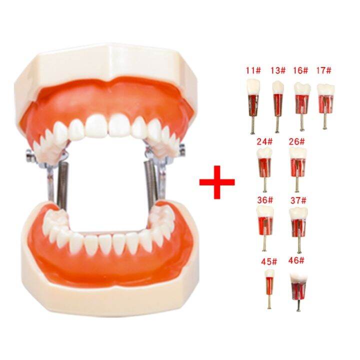 Dental Removable Training model gum teeth With Endodontics Root Canal