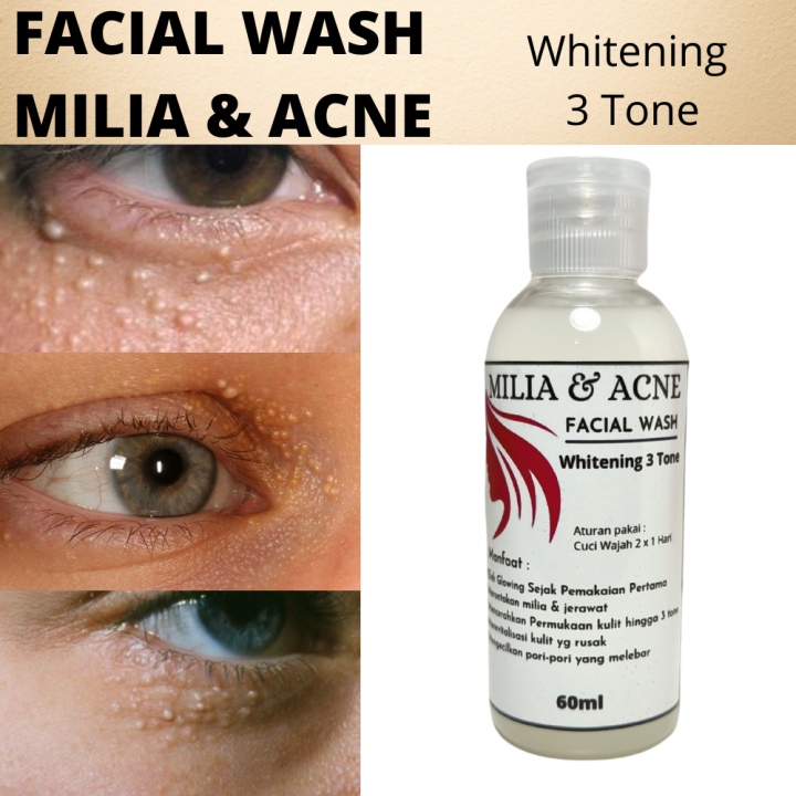 Milia & Acne Facial Wash Whitening 3 Tone / Sabun Cuci Wajah 60 ML