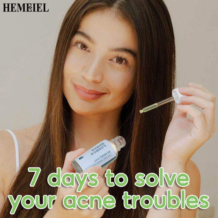 HEMEIEL Acne Serum /Pimple Marks Remover Reduce Acne Acne Care Improve