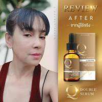 ⚡️ Flash sale ⚡️ Q Double Serum เซรั่มคิว Q serum คิวดับเบิ้ลเซรั่ม ในตำนาน กดติดตามร้านค้า ลดเพิ่ม 10.-บาท