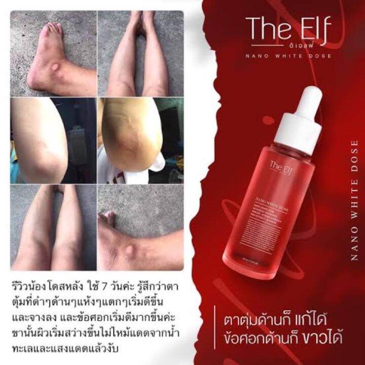 the-elf-โดสแดง-หัวเชื้อเร่งผิวขาว-ตัวดังtiktok