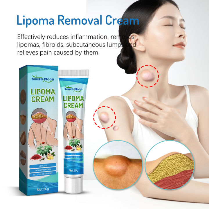 south-moon-สารสกัดจากพืชธรรมชาติ-lipoma-treatment-balm-20g