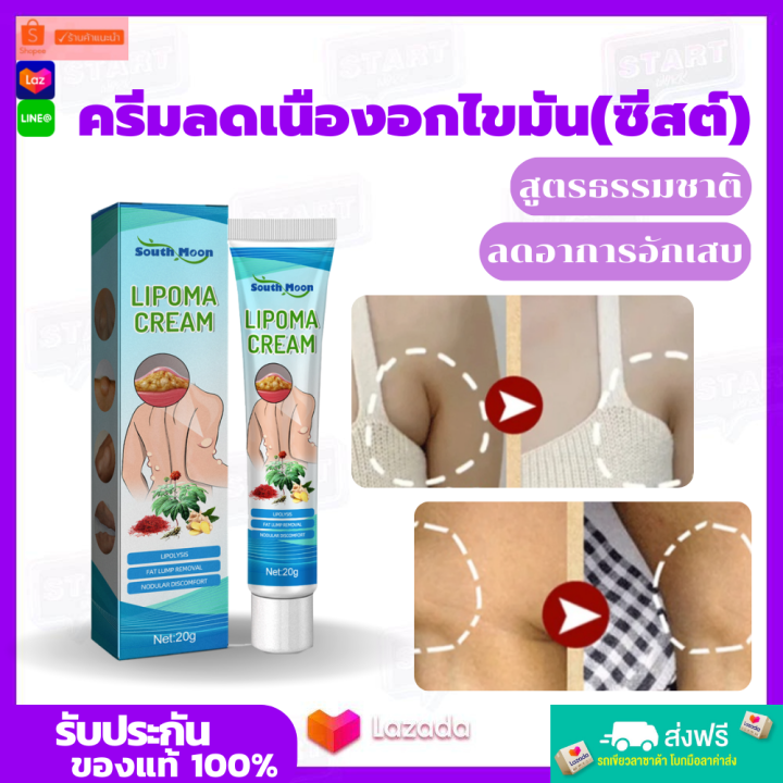 บรรเทาปูนปลาสเตอร์ผิวบวมครีมก้อนใต้ผิวหนัง-สารสกัดจากพืชธรรมชาติ-lipoma-treatment-balm-กำจัดเนื้องอกผิวหนังบวม-ทาแก้ปวด-บำรุงผิวกายเซลลูไลท์